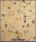 HOMER3 Antibody (Center)